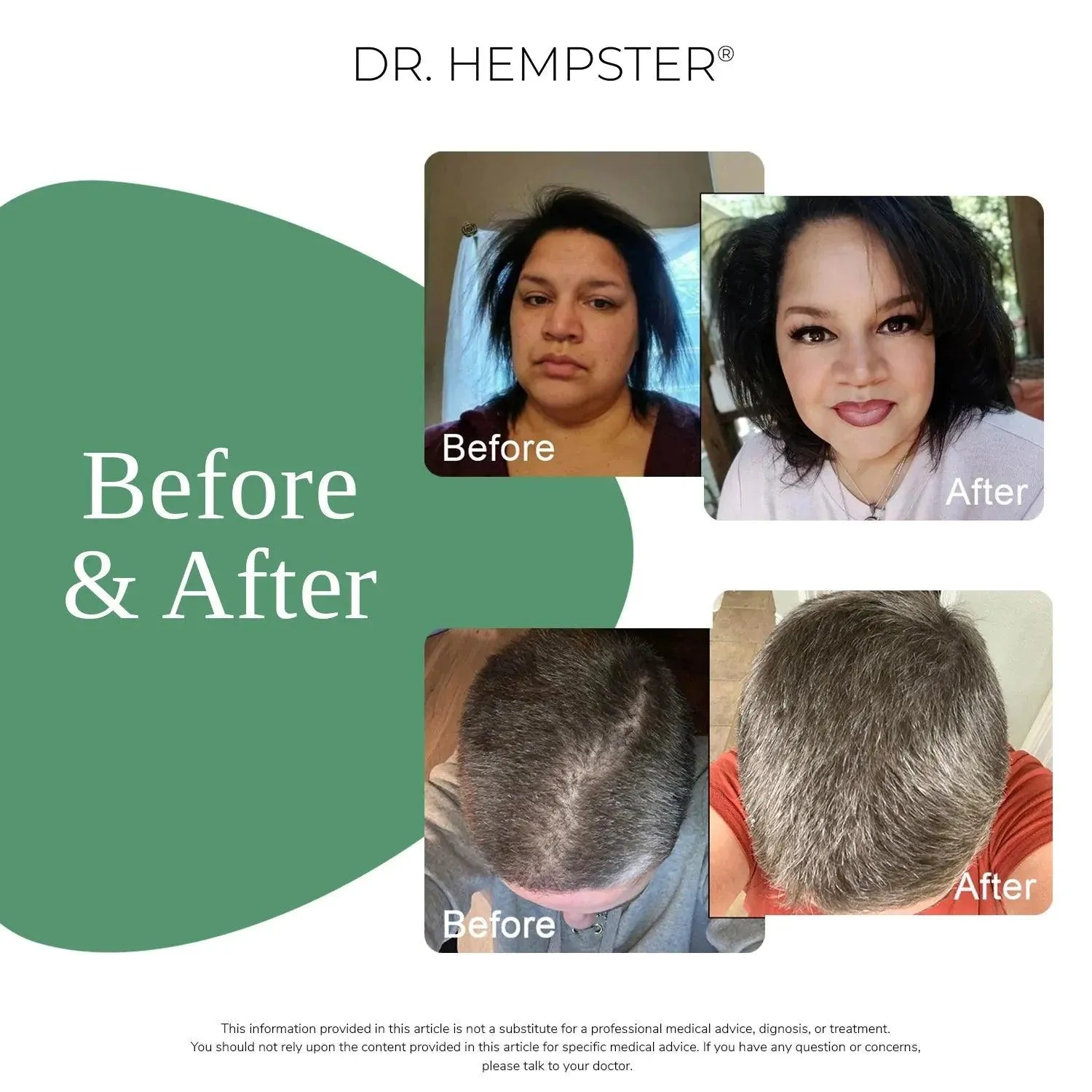 Dr. Hempster Anti-Hair Loss Shampoo