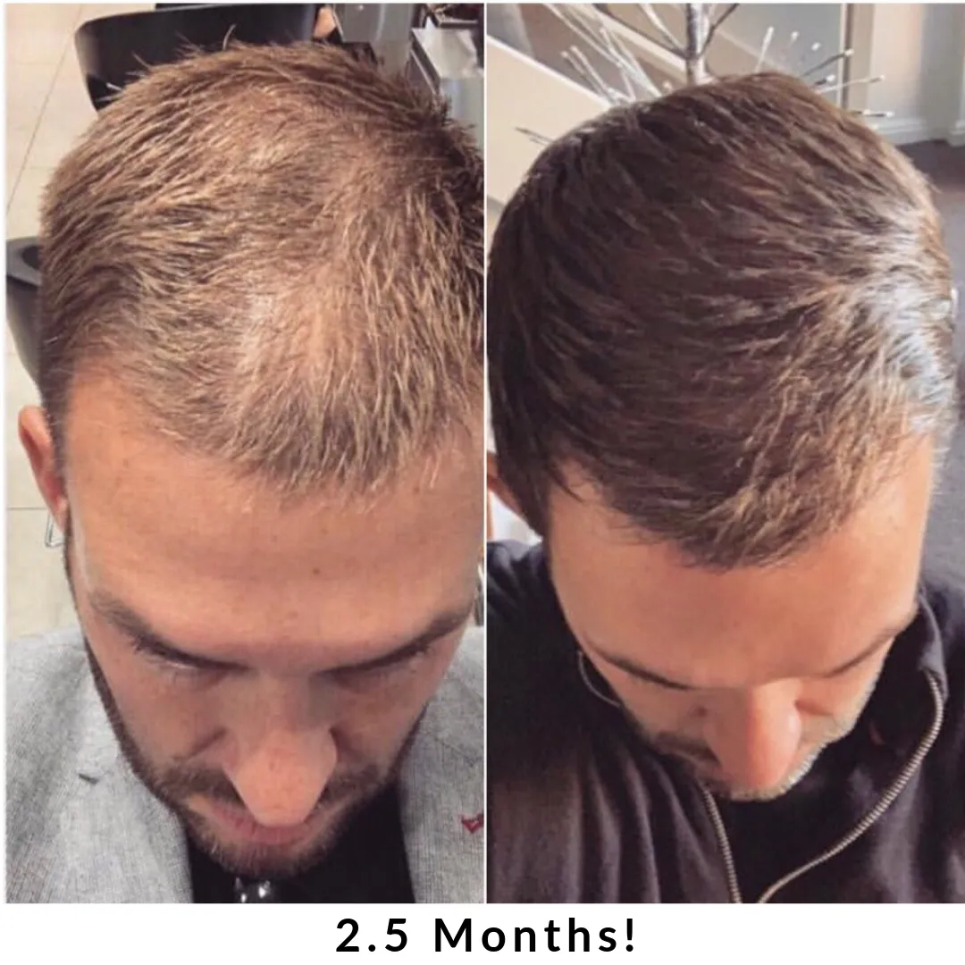 Hair   Energy Formula - 60 Capsules - SIX MONTH SUPPLY