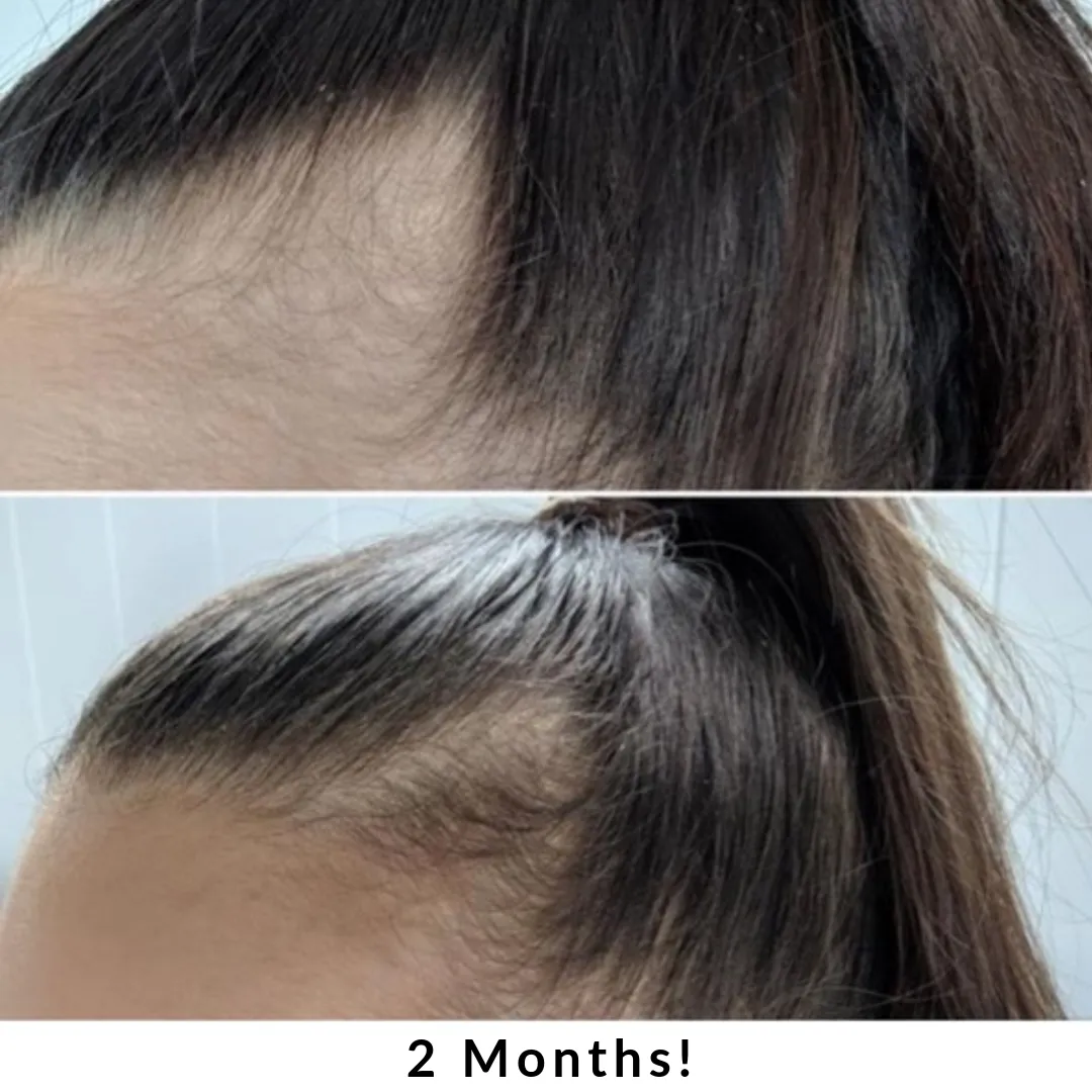 Hair   Energy Formula - 60 Capsules - SIX MONTH SUPPLY